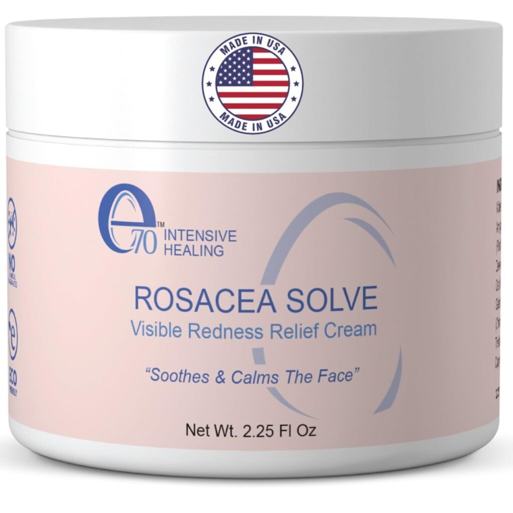 e70 rosacea treatment cream review